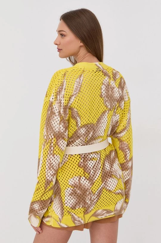 Γυναικεία Με φερμουάρ Βαμβακερή ζακέτα Twinset κίτρινο 5 Γυναικεία Με φερμουάρ Βαμβακερή ζακέτα Twinset κίτρινο - Image 3